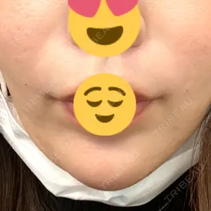 口コミ