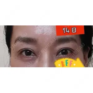口コミ