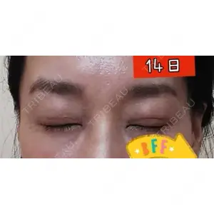 口コミ