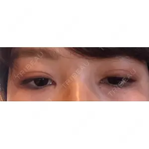 口コミ