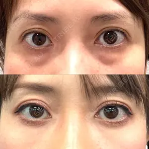 X CLINIC X CLINIC 銀座院口コミ