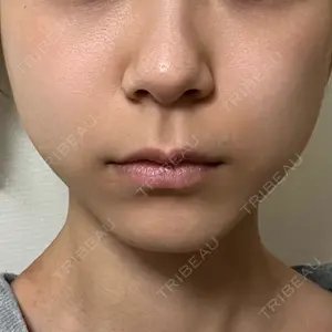 TCB東京中央美容外科 TCB東京中央美容外科 渋谷東口院口コミ