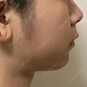 TCB東京中央美容外科 TCB東京中央美容外科 渋谷東口院口コミ