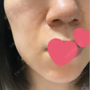 口コミ