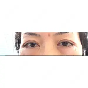 X CLINIC X CLINIC 銀座院口コミ