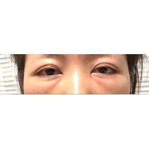 X CLINIC X CLINIC 銀座院口コミ