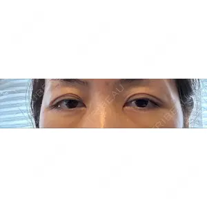 X CLINIC X CLINIC 銀座院口コミ