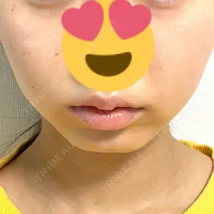 口コミ