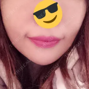 湘南美容クリニック 湘南美容クリニック 新宿本院口コミ