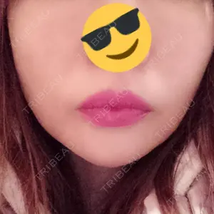 湘南美容クリニック 湘南美容クリニック 新宿本院口コミ
