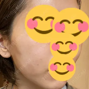 TCB東京中央美容外科 TCB東京中央美容外科 渋谷東口院口コミ