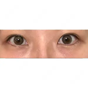 口コミ