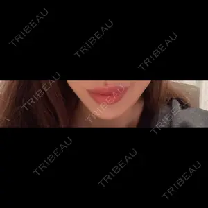 フィラークリニック フィラークリニック 町田院口コミ