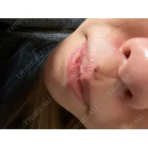 Re:anne clinic 銀座 【リアンクリニック銀座】口コミ