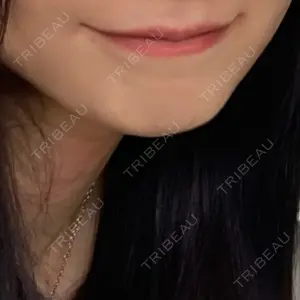 口コミ