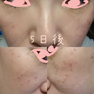 神楽坂美容クリニック タテバ芍薬口コミ