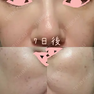 神楽坂美容クリニック タテバ芍薬口コミ