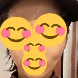 TCB東京中央美容外科 TCB東京中央美容外科 渋谷東口院口コミ