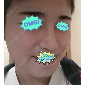 HANABI整形外科口コミ