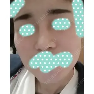 HANABI整形外科口コミ