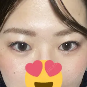 口コミ