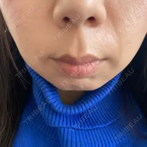 口コミ