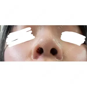 渋谷の森クリニック口コミ