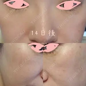 神楽坂美容クリニック タテバ芍薬口コミ