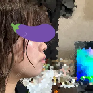 椿クリニック 銀座TSUBAKIクリニック口コミ