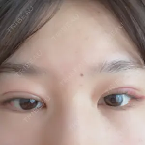 AI Beauty Clinic （エーアイ美容クリニック）口コミ