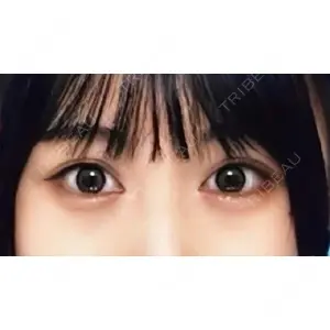 口コミ