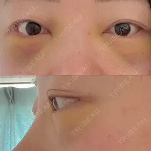 APOLLO BEAUTY CLINIC口コミ