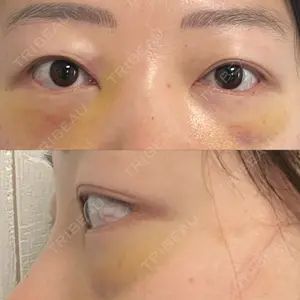 APOLLO BEAUTY CLINIC口コミ