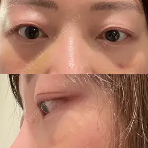 APOLLO BEAUTY CLINIC口コミ