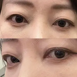 APOLLO BEAUTY CLINIC口コミ