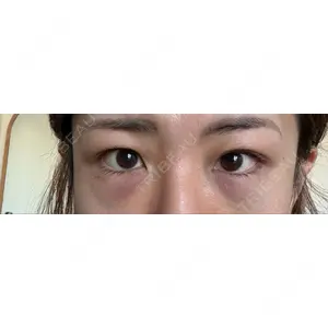 APOLLO BEAUTY CLINIC口コミ