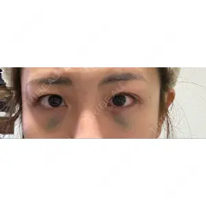 APOLLO BEAUTY CLINIC口コミ