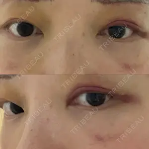 APOLLO BEAUTY CLINIC口コミ