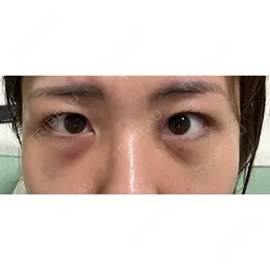 APOLLO BEAUTY CLINIC口コミ