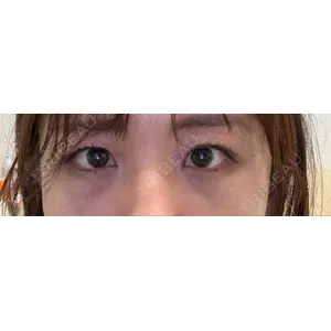 APOLLO BEAUTY CLINIC口コミ