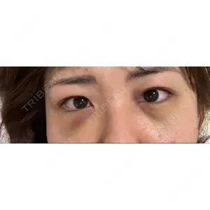 APOLLO BEAUTY CLINIC口コミ