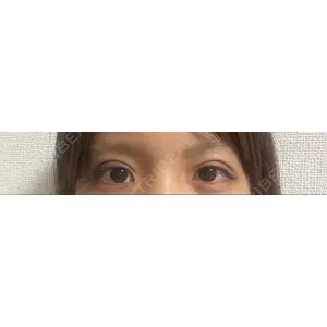 口コミ