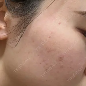 東京美容外科 東京美容外科 池袋院口コミ