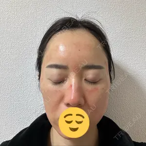 LUNA BEAUTY CLINIC ブリリアスキンクリニック 新宿院口コミ