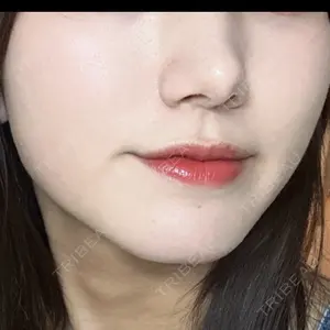 A CLINIC（エークリニック） A CLINIC（エークリニック） 新宿院口コミ