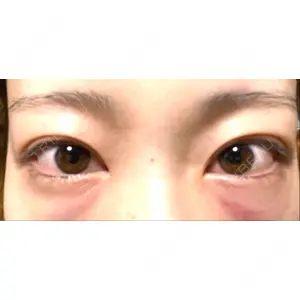 APOLLO BEAUTY CLINIC口コミ