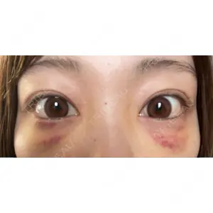 APOLLO BEAUTY CLINIC口コミ