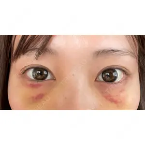 APOLLO BEAUTY CLINIC口コミ