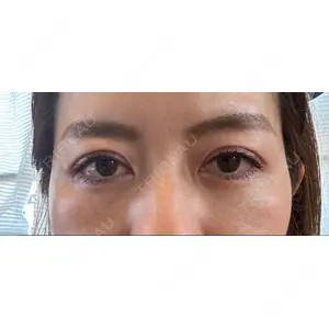 X CLINIC X CLINIC 銀座院口コミ