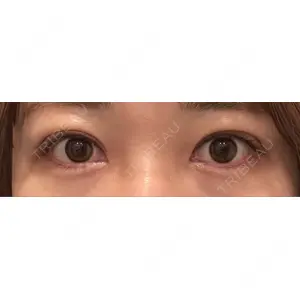 湘南美容クリニック 湘南美容クリニック 池袋東口院口コミ